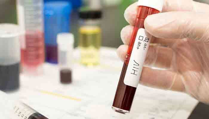 Representational image of HIV blood test. — APP File