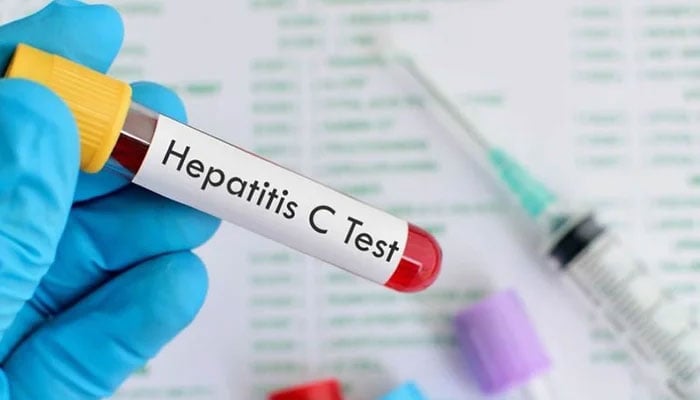 A representational image showing a blood sample with Hepatitis C written on it. — Pixabay/File