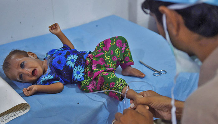 A medic treats a baby girl at Mithi Civil Hospital in Mithi, Sindh. — AFP/File