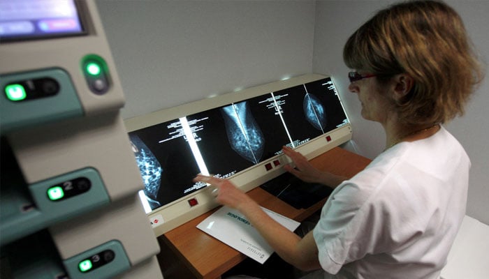 A radiologist examines breast X-rays after a cancer prevention medical check-up at the Ambroise Pare hospital in Marseille, southern France, on April 3, 2008. — Reuters