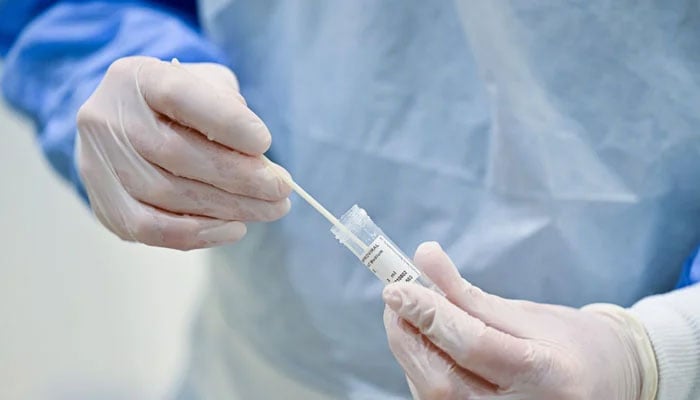 A representational image showing a medical professional holding a testing swab. — AFP/File