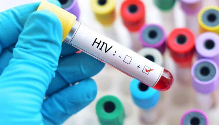 A medical practitioner holding a test tube for HIV test. — AFP/File