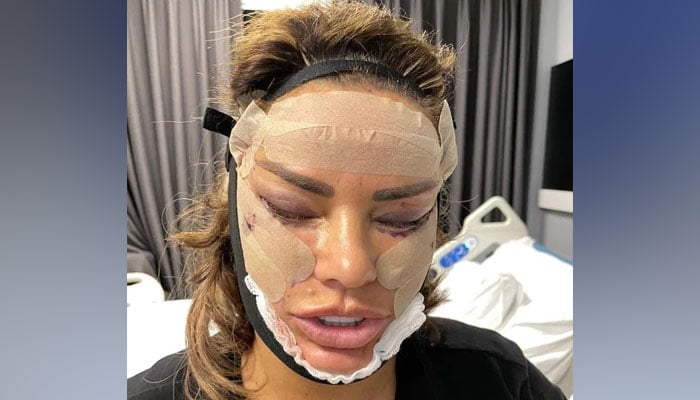 Katie Price shares heart-wrenching details of her cosmetic surgery in new video