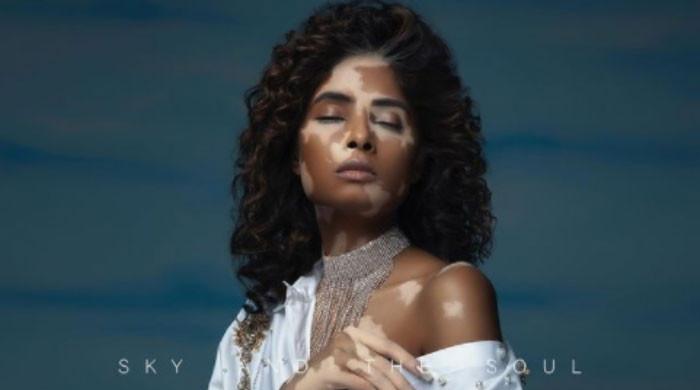 Pakistani photographer under fire for ‘mocking’ vitiligo skin condition ...