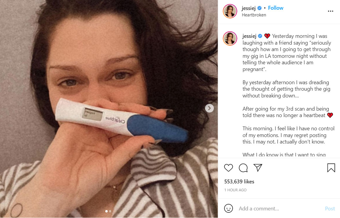 Jessie J announces painful pregnancy loss announcement: ‘There’s no more heartbeat’