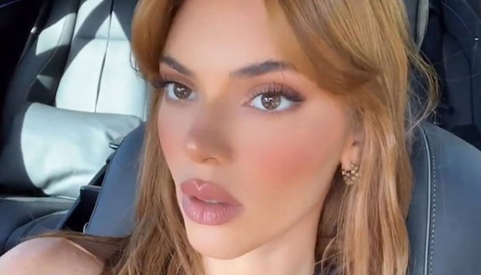 Kendall Jenner gets lip fillers? New photo leaves fans in shock!