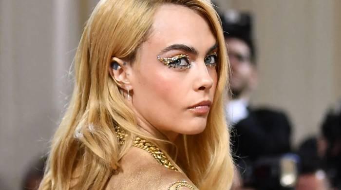 Cara Delevingne 'flaunting her psoriasis' at Met Gala melt down ...