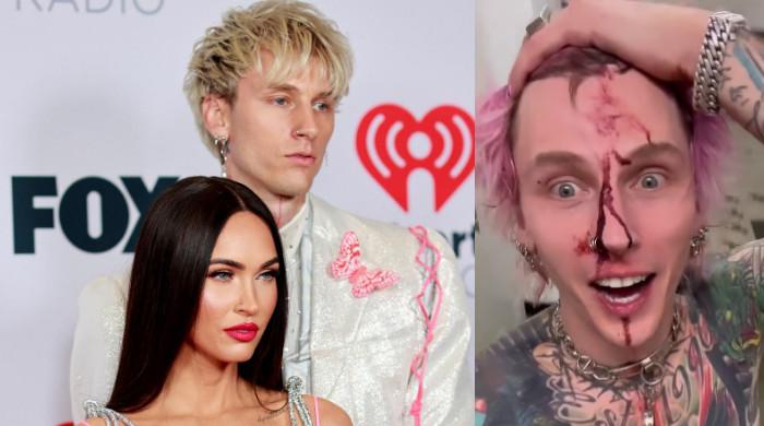 Machine Gun Kelly Shares Bloody Photo Amid Rumours Of Megan Fox Split