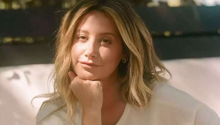 Ashley Tisdale dishes over hairless, self-esteem struggles with Alopecia