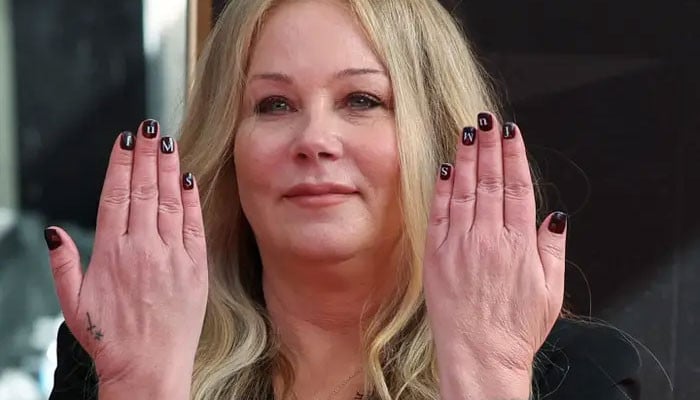 Christina Applegate Claps Back Against Claims ‘plastic Surgery Changed ...