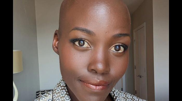 Lupita Nyong’o shows off striking new look with fresh buzzcut
