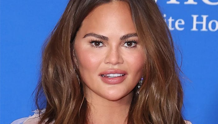 Chrissy Teigen bashes critics saying she ‘destroyed her face’: ‘I just gained weight!’