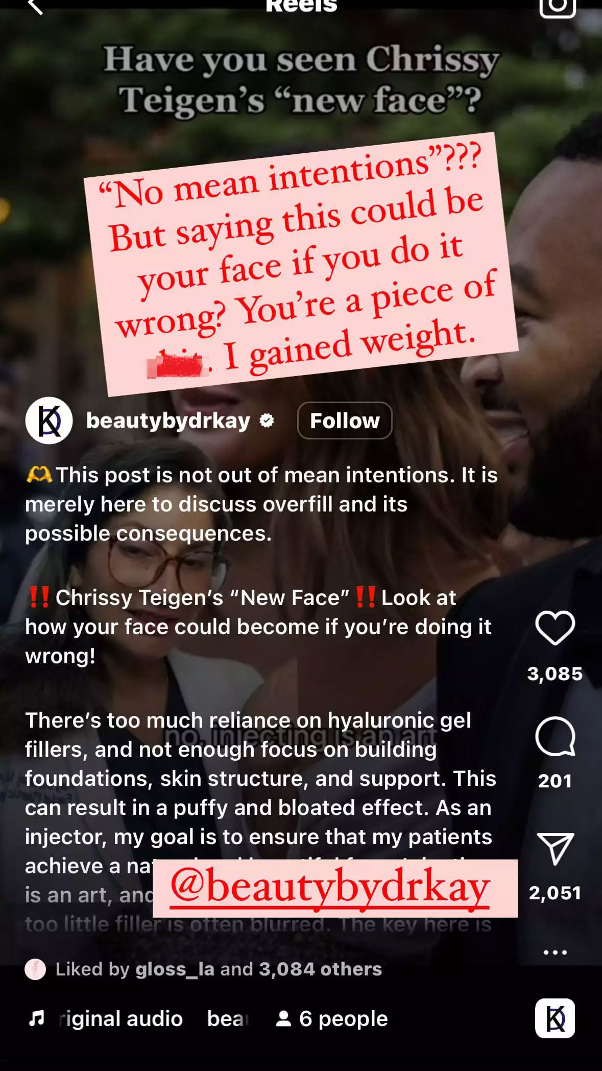 Chrissy Teigen bashes critics saying she ‘destroyed her face’: ‘I just gained weight!’