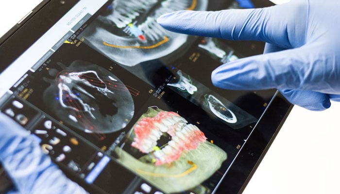 This representational picture shows a dentist examining a digital X-ray result of a patients teeth. — Unsplash/File