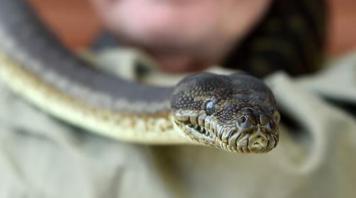 Live snake roundworm found inside woman's brain, doctors shocked