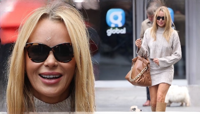 Amanda Holden spotted with mysterious mark on her forehead