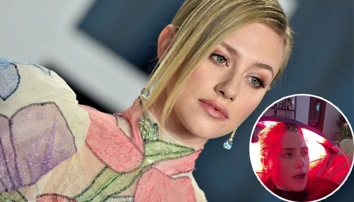 Lili Reinhart revealed that she is undergoing red light therapy for her alopecia