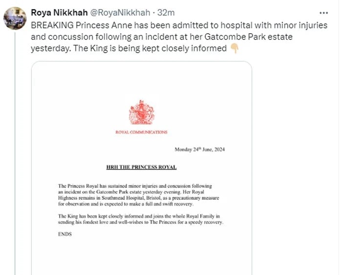 Raja Charles mengirimkan pesan yang kuat saat Putri Anne masih di rumah sakit