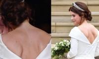 Princess Eugenie Living With A Scar For Years