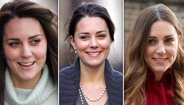 Kate Middleton’s teen emergency surgery leaves scar.