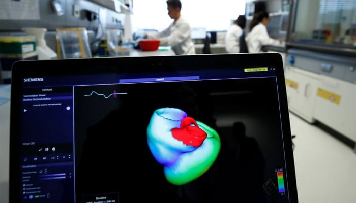 3D image of a heart in a cardiology test.— Reuters/file