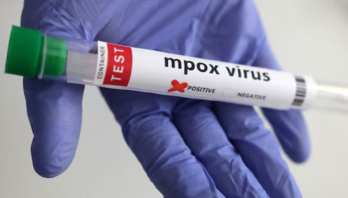 A test tube labelled Mpox virus positive is held in this illustration taken August 20, 2024. — Reuters