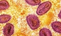 India Reports First Mpox Case Of Rapidly Spreading Clade 1b Variant 