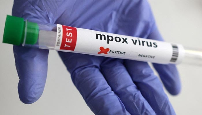 A test tube labelled Mpox virus positive is held in this illustration taken August 20, 2024. — Reuters