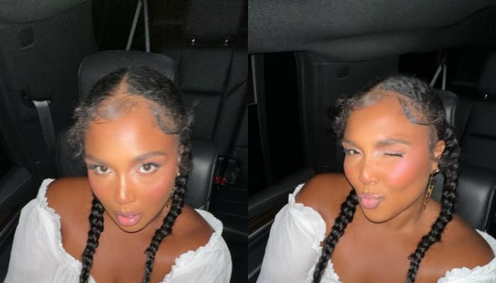 Lizzo shocks fans with jaw-dropping weight loss transformation