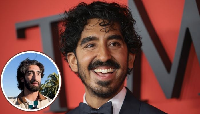 Dev Patel revealed that he didnt stand a chance of winning his look-alike contest.